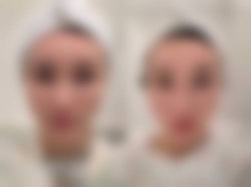 西安热玛吉官方认证医院查询？看这几家口碑好性价比高的机构，助你抗衰无忧！ 