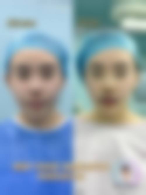 北京联合丽格怎么样？正规靠谱、技术过硬且口碑良好的医美机构了解一下！ 