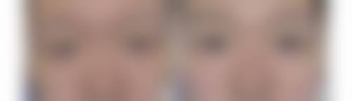 如何选择像东莞华美这样的医美机构