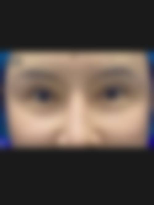 西安开双眼皮哪家医院做得好？特色技术医院盘点