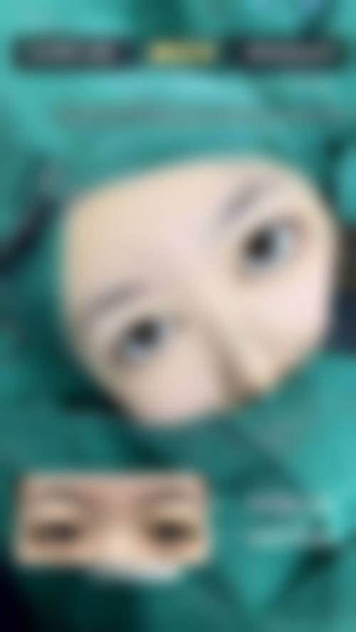 西安开双眼皮哪家医院做得好？性价比高的医院推荐