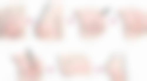 医生技术对注射玻尿酸隆胸副作用的影响