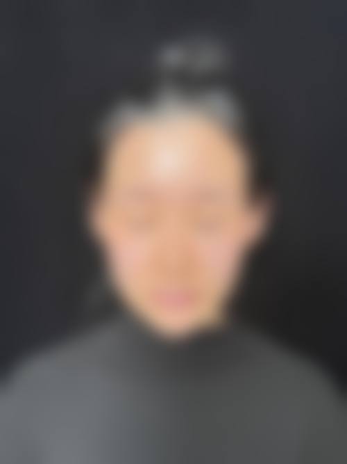 西安开双眼皮哪家医院做得好？前十医院大揭秘，让你轻松拥有灵动双眼！ 