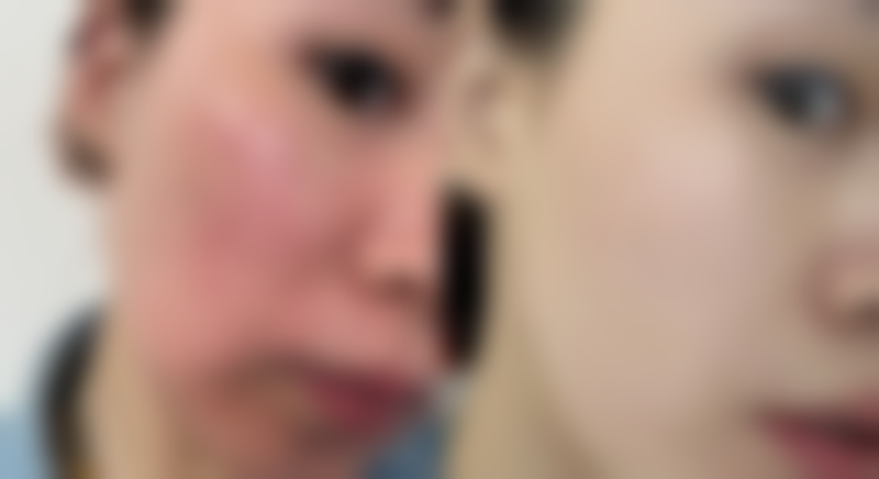 宁乡桃花仙整形医院收费价格参考