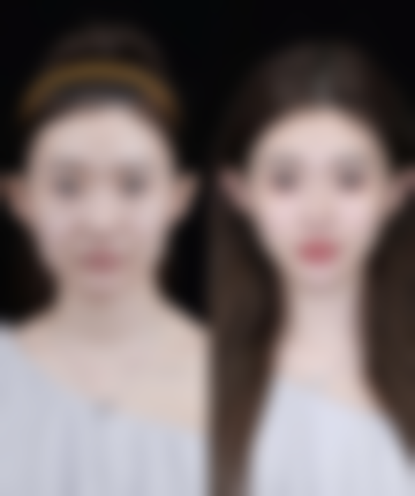 昆华医院点阵激光价格与地区差异