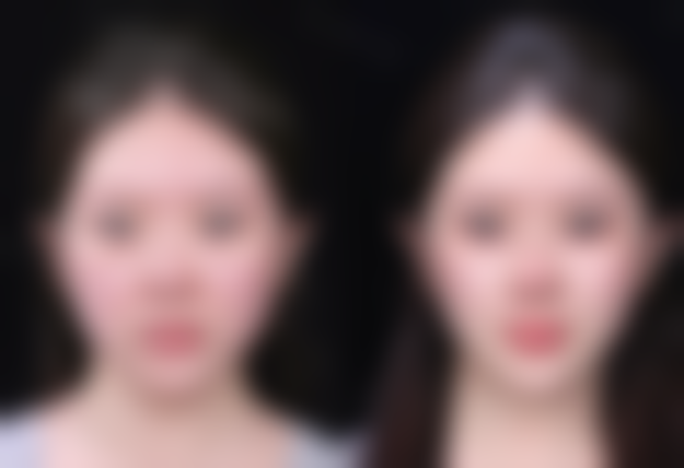 五、雷中元如何成为“自然美鼻奥美鼻医生”？