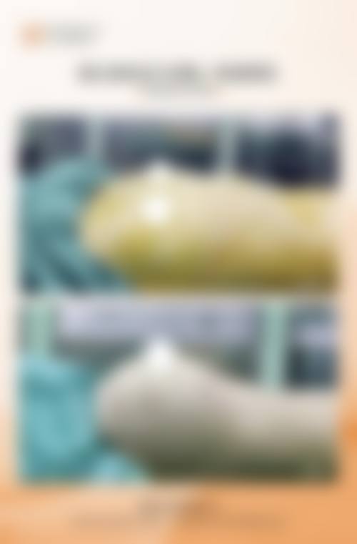 衡阳爱思特和雅美哪个好——服务质量大比拼