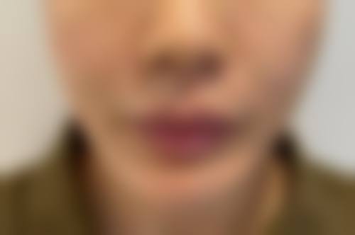 池州灵创医疗美容——排名榜上的明星医院