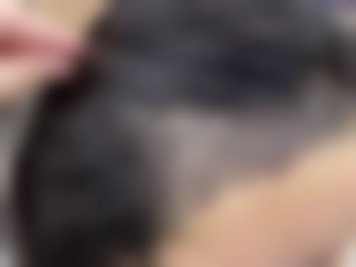 云南昆明春草世纪植发医院预约挂号方式