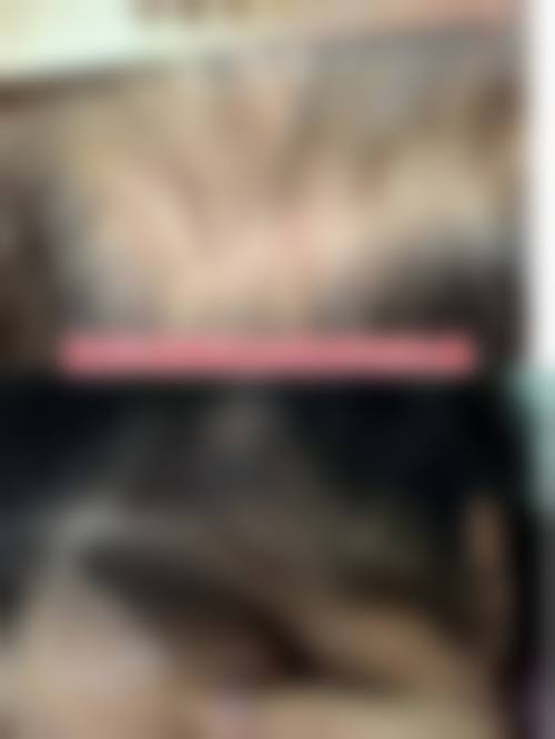 云南昆明春草世纪植发医院患者口碑评价