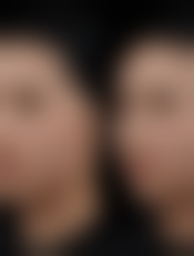 衡阳爱思特和雅美哪个好？爱思特医生经验足，雅美性价比高，各有千秋！ 