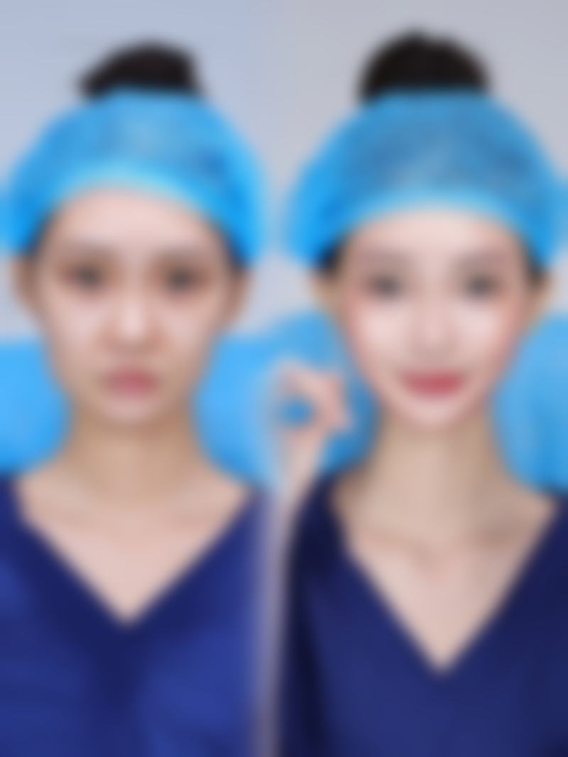 深圳医美汇医疗美容医院患者口碑评价