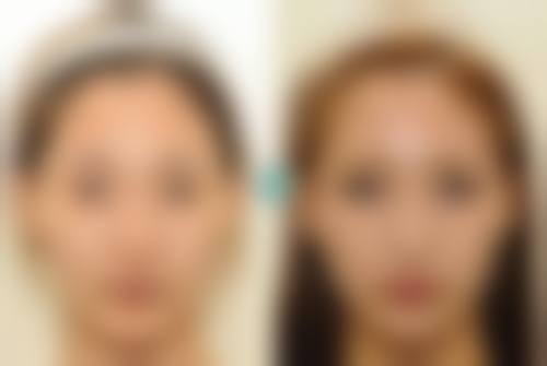 龙岩第一医院整形外科怎么样？技术优、项目多、口碑好，给你超棒变美体验！ 