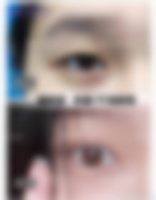 龙岩第一医院整形外科医生团队实力如何