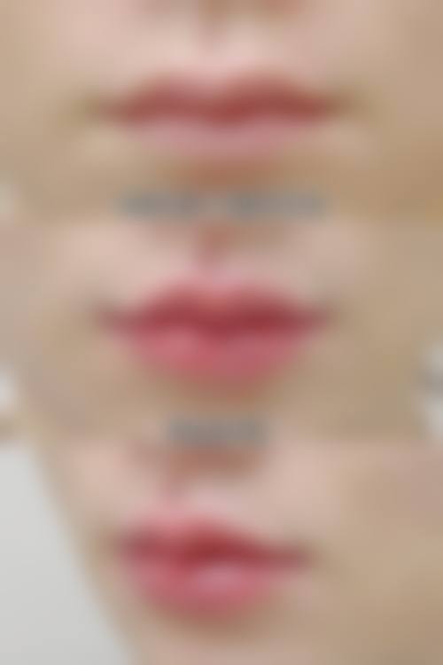 二、这些医院在面部整形上有何优势？