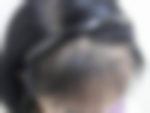 四、郑州碧莲盛植发有何亮点？