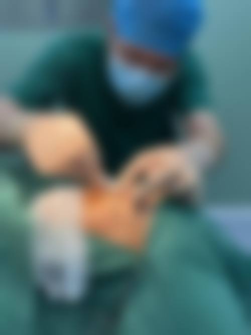 二次隆鼻手术的时机选择特别重要