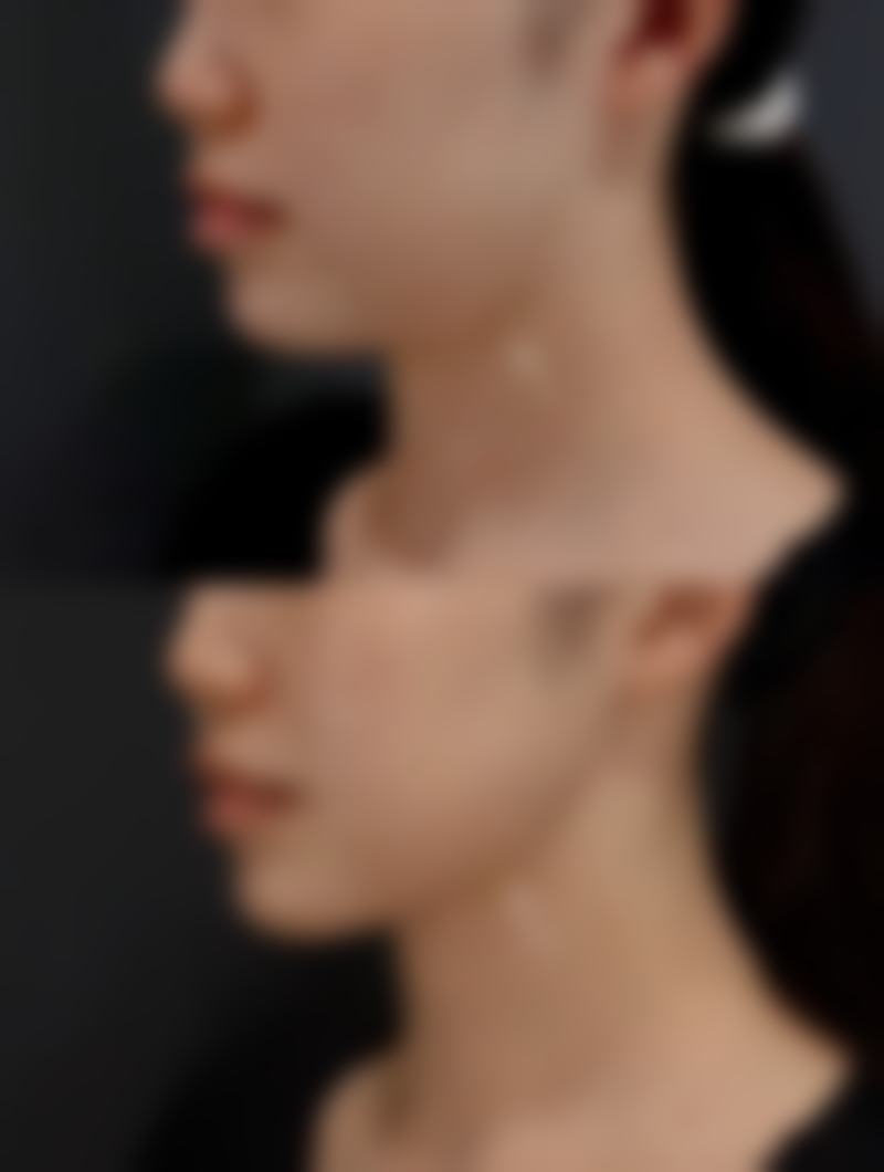 杭州艾丽娅医疗美容诊所口碑评价怎么样？