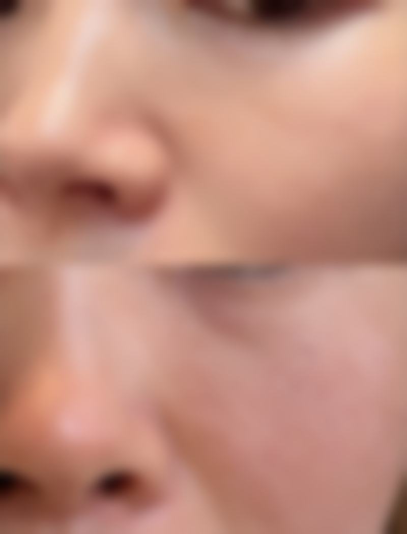 术前评估严谨，风险控制到位