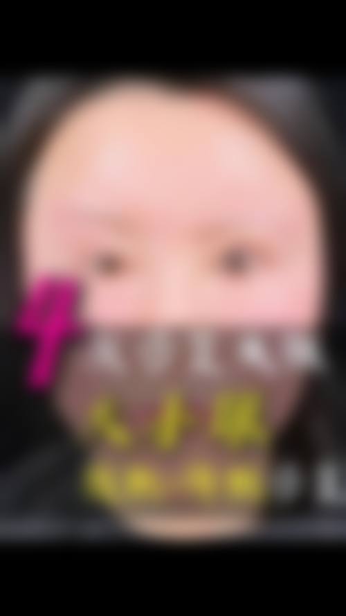 深圳市人民医院整形外科价格表：双眼皮6500 - 12000、硅胶隆鼻9800 - 25000，技术优势显著！ 