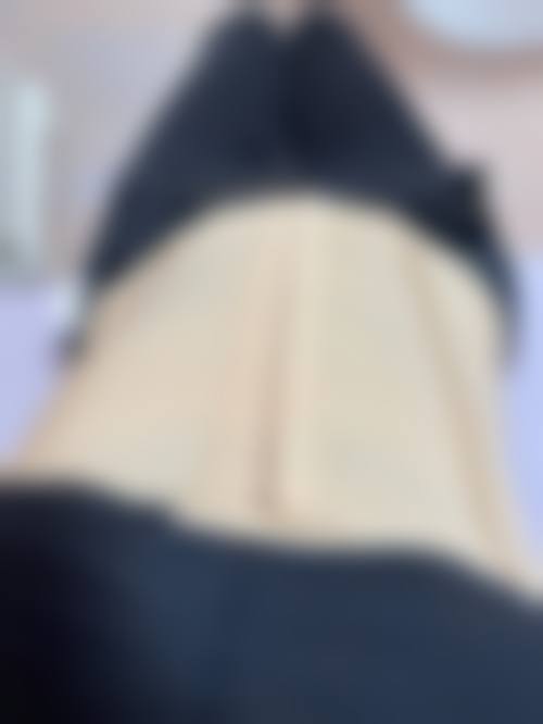 腰腹吸脂相关情况