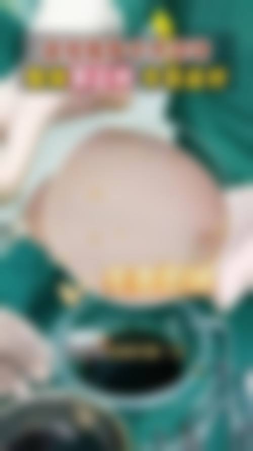 南京康美整形医院真实实例与优势