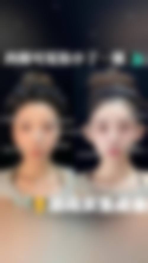 洛阳平民医院医疗美容整形中 心整体情况介绍