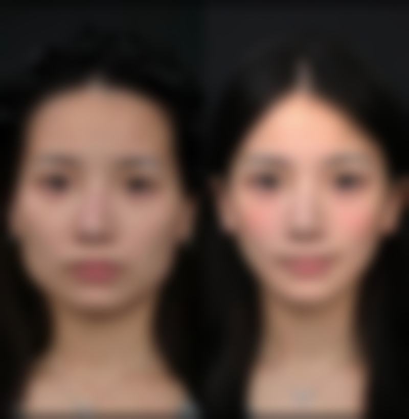 四、国产膨体品牌亮点