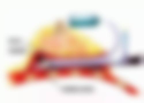 假体隆胸的修复时间