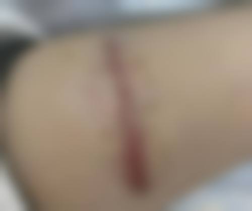 沈阳老牌医美专科，友谊医院实力强