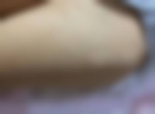 嫩肤抗衰项目一览