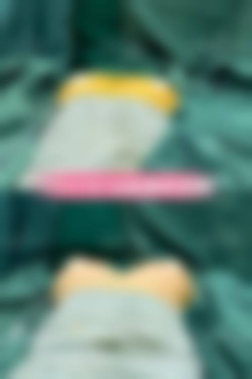 促进隆胸修复的方法
