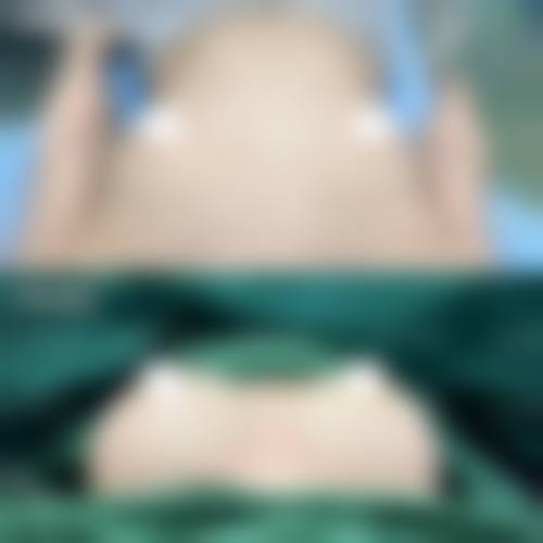 五、北医三院隆胸的优势及价格合理性