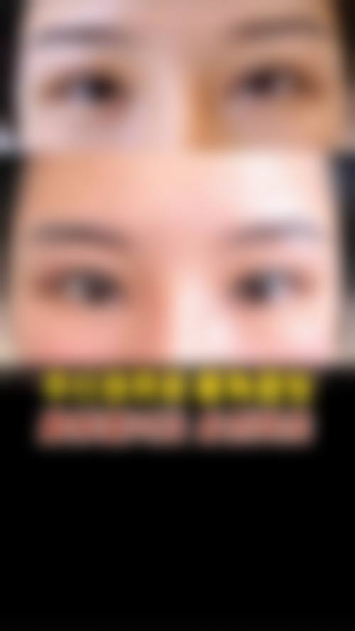 复杂修复：攻克眼部疑难问题
