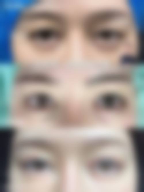选择建议：理性看待价格与成效