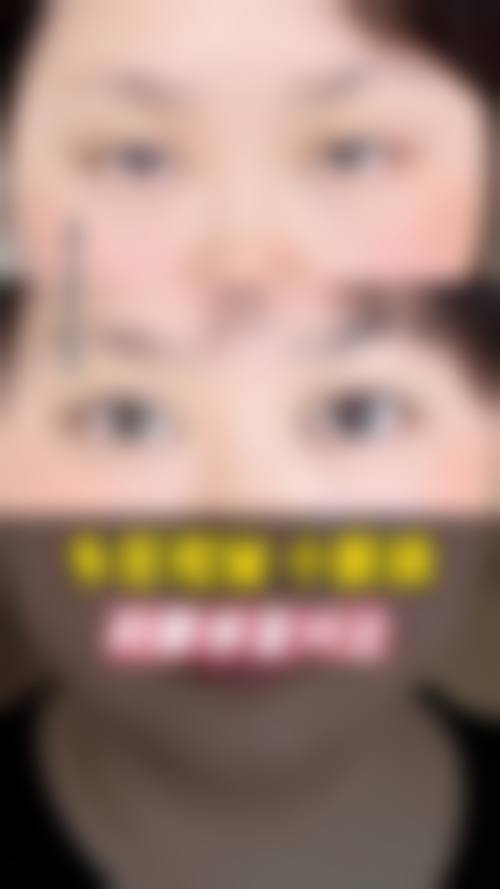 高难度修复：挑战眼部修复极限