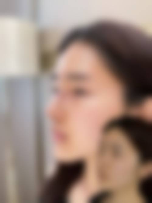鼻综合手术：成效与优势解析