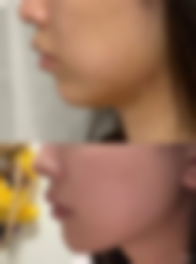 泉州美莱华美：抗衰与微整形的佼佼者