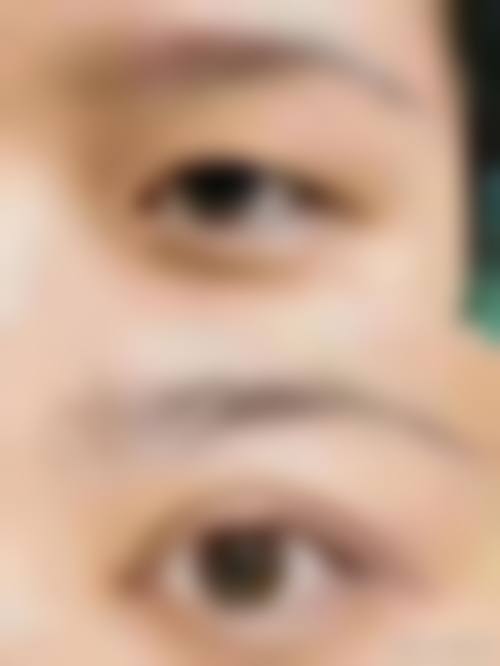 北京八大处张倜然失败实例不存在！多院区坐诊，多样术式+精细技术收获满满好评