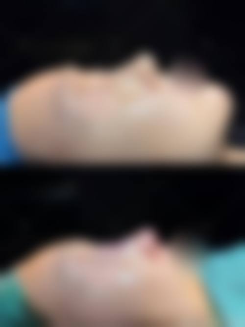 8. 抗衰除皱项目，价格更新开启逆龄之旅？