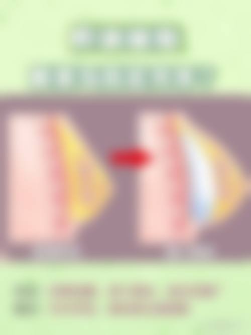 五、选择成都美莱的注意事项