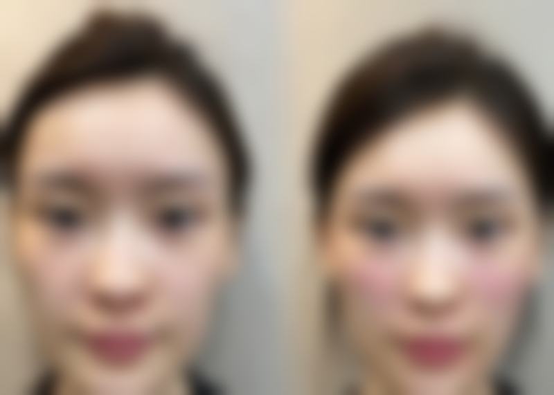 武汉绎君整形医疗美容医院综合评价