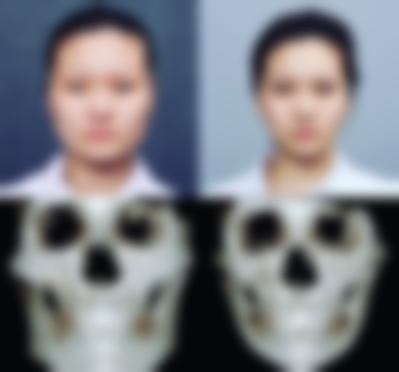 三、磨骨价格背后的价值体现
