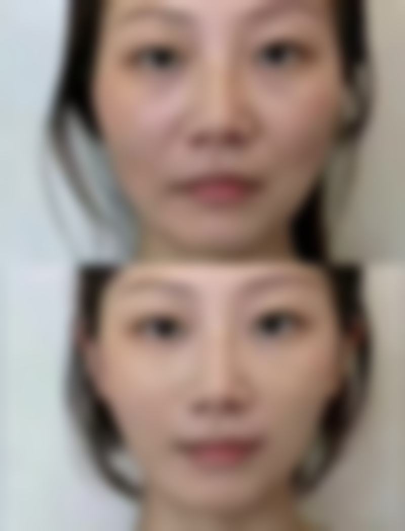 五、术后修复助力理想成效