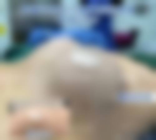 公立医院丰胸收费标准？多种手术方式费用大揭秘，价格区间全知晓！ 