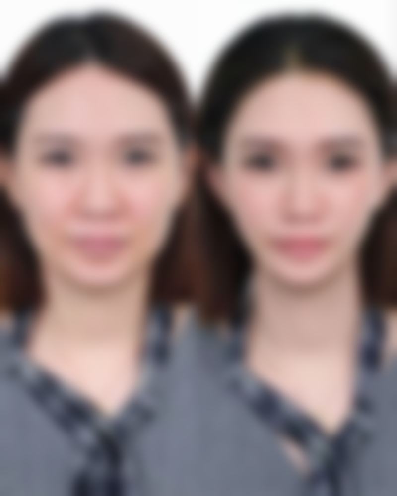 🌟义乌慕莎整形医院的项目