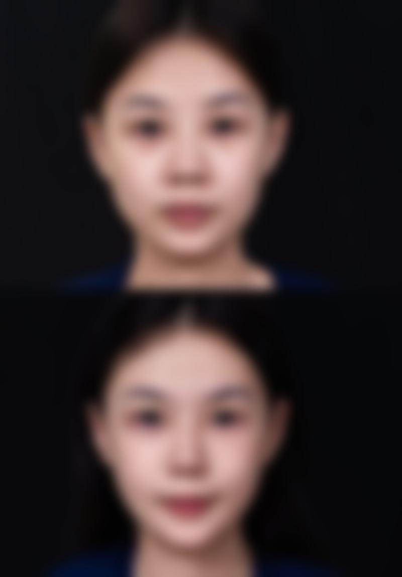 二、深圳郝剑杰医生技术如何