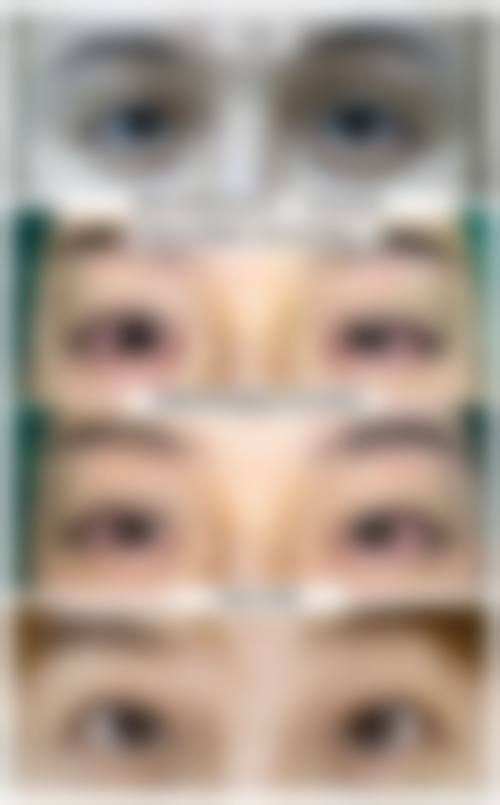 面诊的注意事项