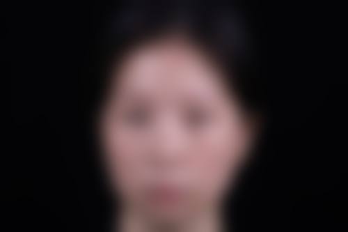 美容院去眼袋的常见方式及成效