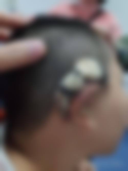李承祐医生收费贵吗？